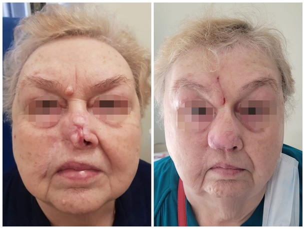 „Pomagam tam, gdzie kończy się standardowa medycyna, a zaczyna psychologia postrzegania – dr n. med. Piotr Rot.