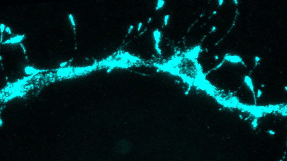 Naukowcy z MIT odkryli, że w filopodiach ukrywają się synapsy, gotowe do stworzenia nowych połączeń