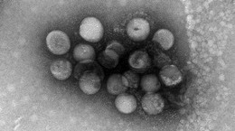 Kolejne koronawirusy mogą zagrażać ludziom? Naukowcy zaniepokojeni