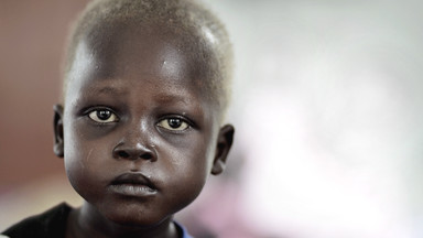 Sudan Południowy: niemal milion dzieci w obliczu śmierci głodowej