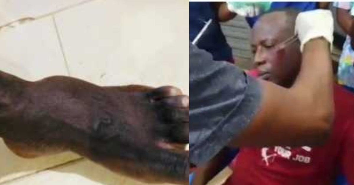 Armed robbers attack University of Ghana professor, 2 police officers injured - Vimarsana News