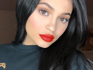 Kylie Jenner megvált szájimplantátumától mi pedig mutatjuk, hogyan történik ez a valóságban!