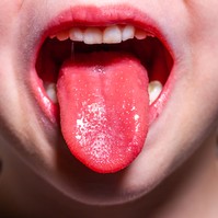Skarlát betegség: oka, tünetei, lefolyása és kezelése