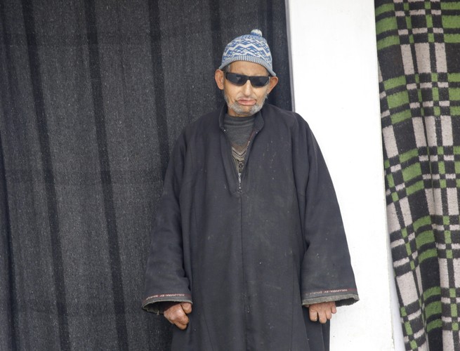 SZPITAL DLA TRĘDOWATYCH W KASZMIRZE