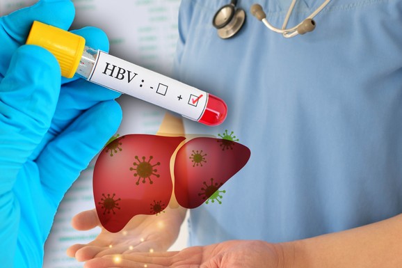 Novi lek protiv virusa koji izaziva rak i otkazivanje jetre: Naučnici suzbili hepatitis B i otvorili put ka izlečenju