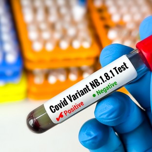 Felbukkant egy új covid-variáns, ami más, mint a többi: ezt kell tudni az NB.1.8.1-ről