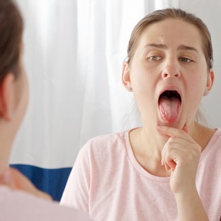 Lepedék a nyelven, dudor a szájban: ekkor jelez gombás vagy bakteriális fertőzést