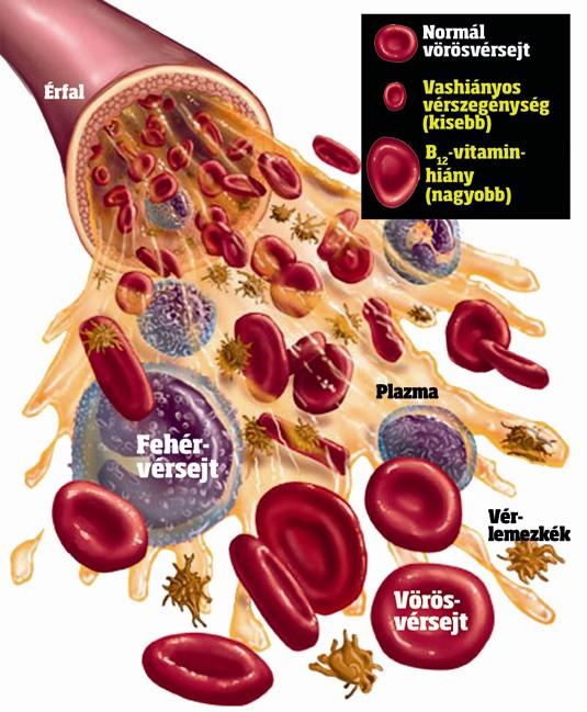 A vérszegénység (anaemia) tünetei