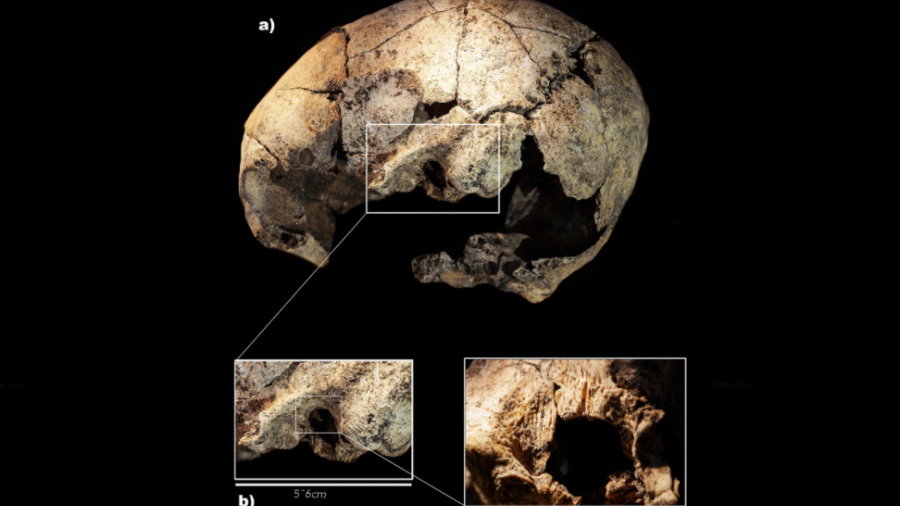 Operacja ucha sprzed 5 tys. lat? Intrygujące znalezisko w Hiszpanii, fot. S Díaz-Navarro et al. 2022, Scientific Reports. CC BY 4.0