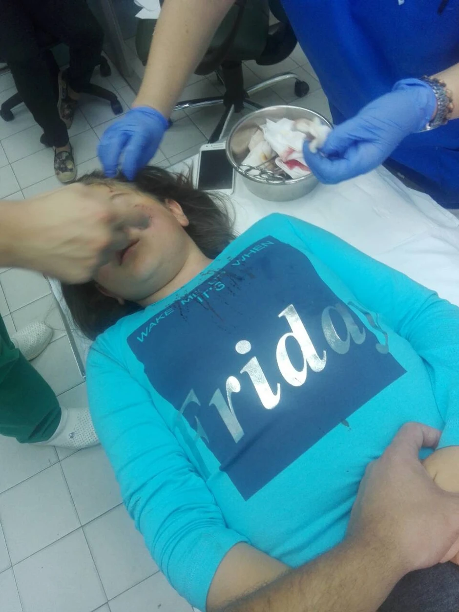 Otvorene rane su sanirane brzom reakcijom lekara