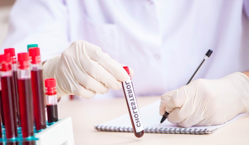 Dugoročno povećanje holesterola obično se dešava nakon konstantnog unosa zasićenih masti, trans masti i prerađene hrane 