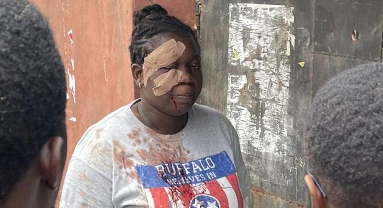 The woman voted despite the attack that left her face bandaged [Twitter/@Ozoadaz]
