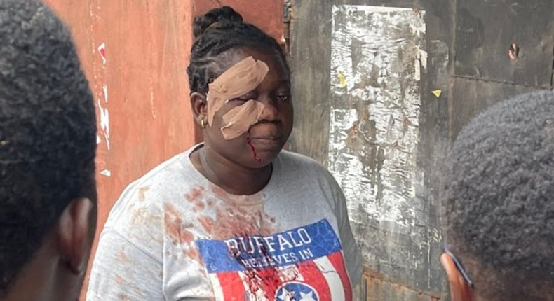 The woman voted despite the attack that left her face bandaged [Twitter/@Ozoadaz]