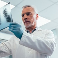 Mellkasröntgen: ezeket az elváltozásokat, betegségeket mutatja ki