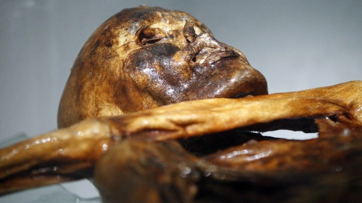 Otzi