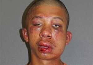 495552_napadac-pretucen