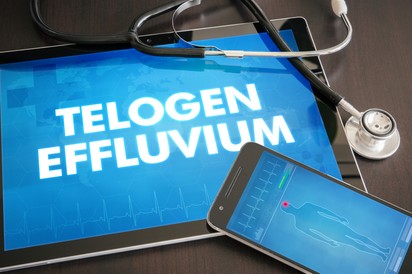 Hajhullás (telogén effluvium) oka, tünetei és kezelési lehetőségei