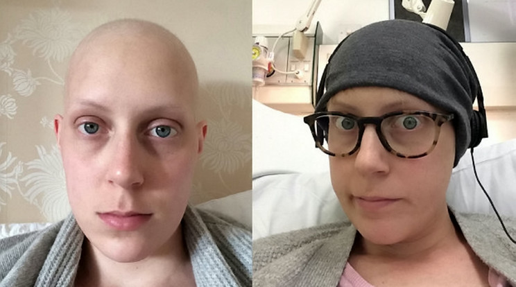 Két éve már kiműtöttek 
egy daganatot a nőből /Fotü: Northfoto