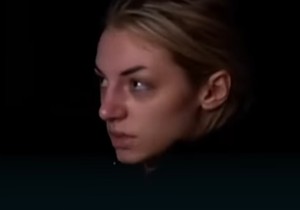 Devojka koja je preživela požar u diskoteci u Kočanima