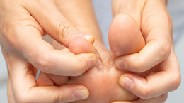 Seven signs of diabetes can be seen in your feet.  Warning signs that you have too much sugar