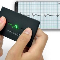 Hát az ön EKG-ja milyen? Mérje meg otthon!