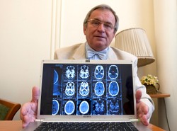 Transplantolodzy nie lubią cudotwórcy