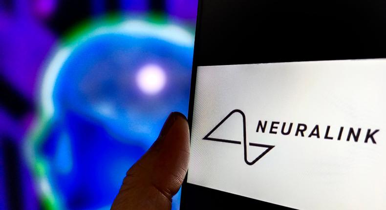 Neuralink revealed the first human patient to receive its brain-chip implant in MarchNurPhoto