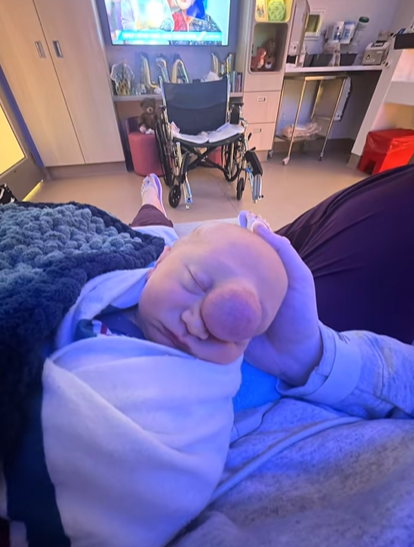 Ochorenie Liamovi poškodilo mozog.