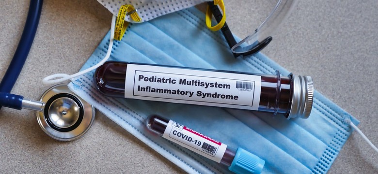 Dr Okarska-Napierała: Jesteśmy na początku kolejnej fali PIMS w Polsce