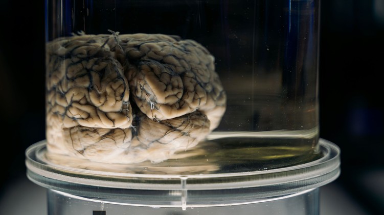 Einstein agy vizsgál kutatás