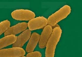 pestis-yersinia-d00000B6C08356e3333fb