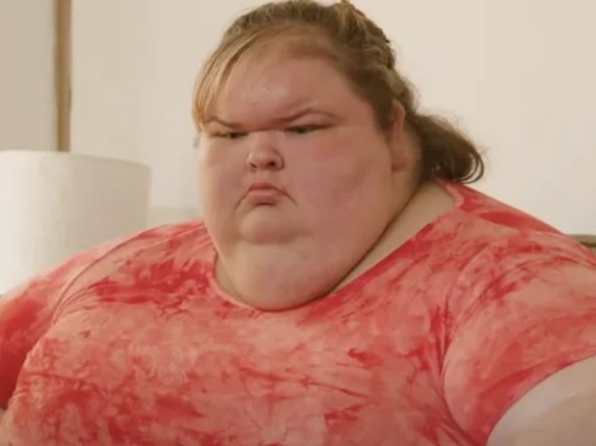 Imala je preko 300 kg, a sad je smršala 227 kg, skunula višak kože i zadvilia svet