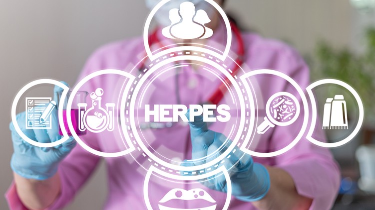 nemi herpesz, tünetei, kezelése, gyógymód, vírus,  HSV-1, HSV-2, herpeszvírus