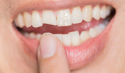  Ruszają ci się zęby? To może być objaw raka 