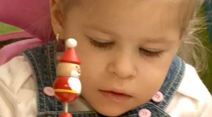 Agybénulásban szenvedő kislányon segítettek fánksütéssel Miskolcon /Fotó: RTL