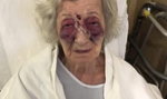 92-letnia staruszka brutalnie pobita podczas podróży do córki. "Ciekła mi krew z nosa, nie wiedziałam co robić"