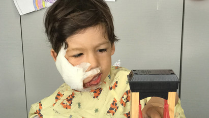 Nagyon ritka betegségben szenved a hároméves kisfiú: az arca jobb oldala gyorsabban nő - fotók