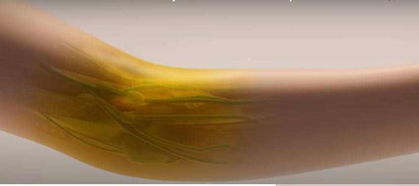 Naučnici su pokazali kako nanošenje uobičajene boje za hranu na telo, može da učni kožu providnom