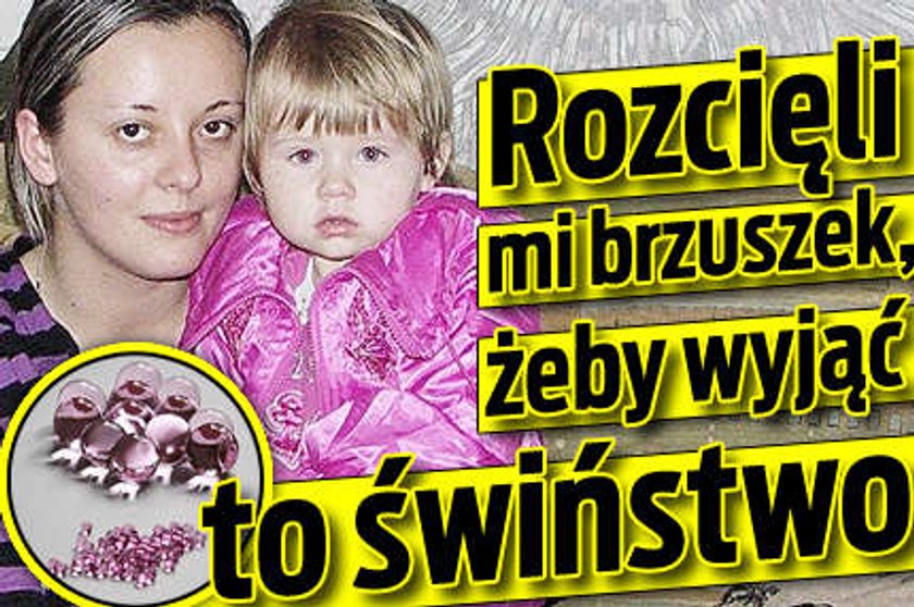 Rozcięli mi brzuszek, żeby wyjąć to paskudztwo