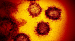 Odporność na koronawirusa SARS-CoV-2