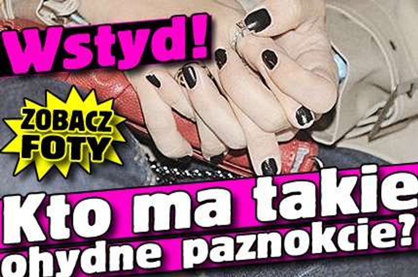 Wstyd! Kto ma takie ohydne paznokcie?