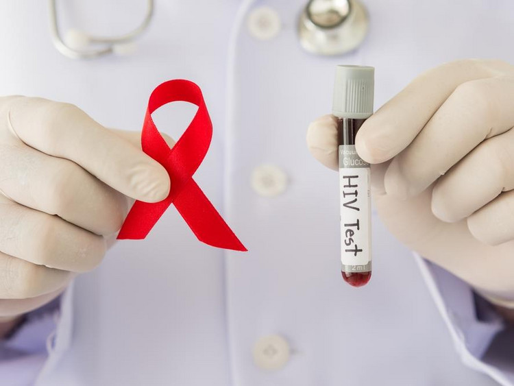 Kiedy poddać się testowi w kierunku HIV?