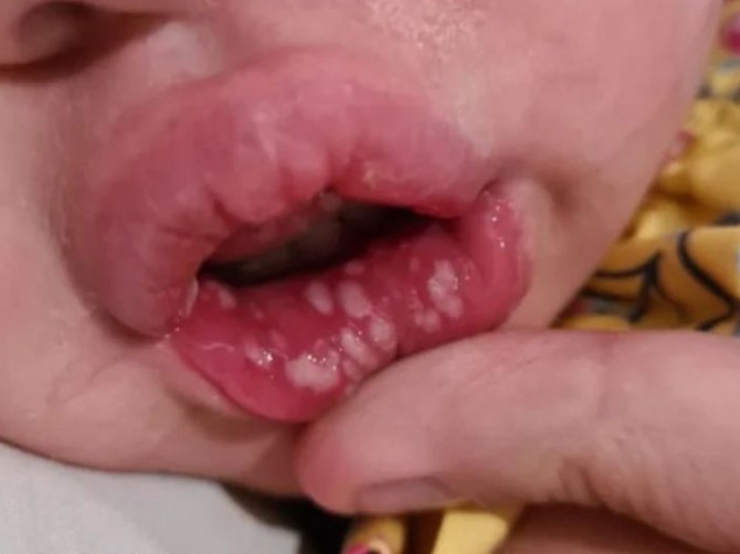 Mama je upozorila ljude na društvenim mrežama