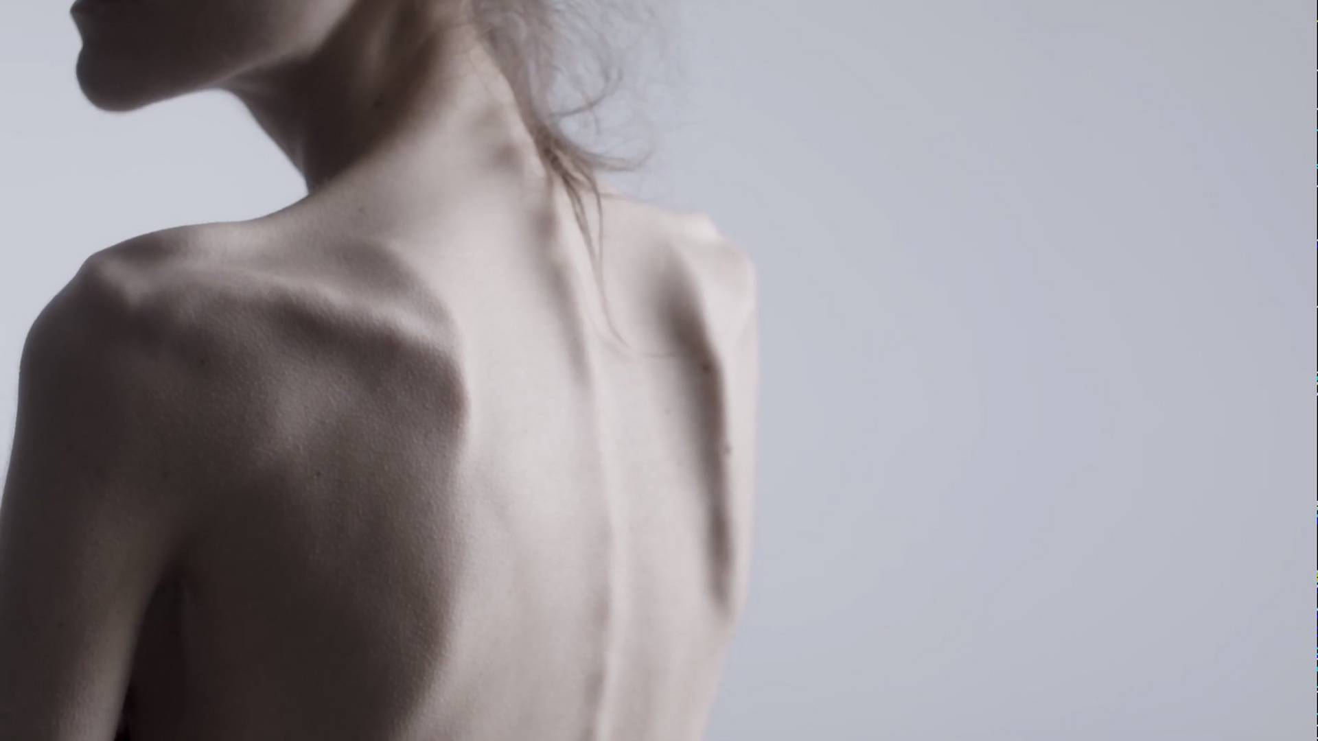 Anoreksja zabija co 62 minuty. Rusza mocna kampania motywująca do walki z chorobą