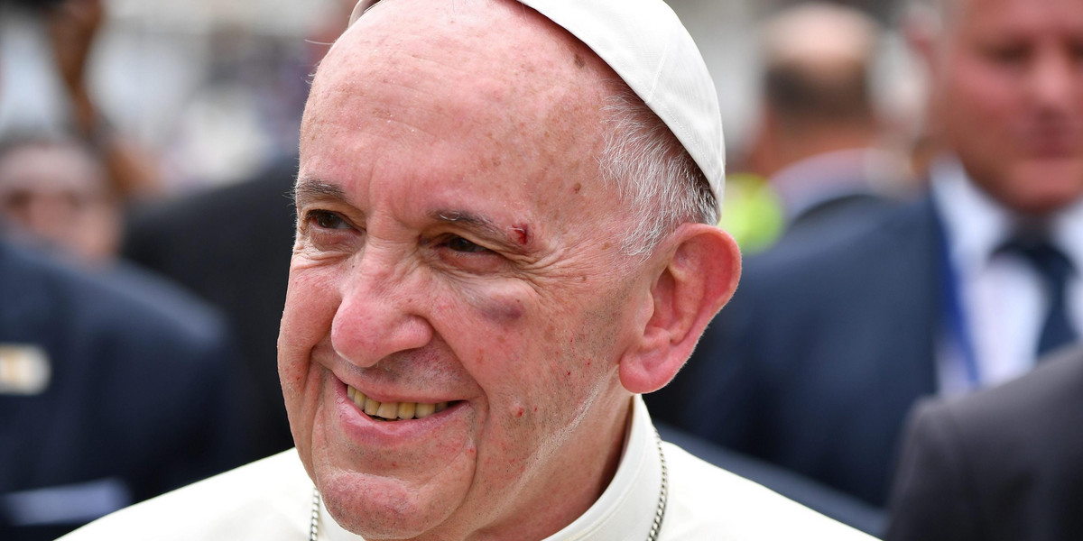 Wypadek papieża w Kolumbii. Krew na twarzy i sutannie