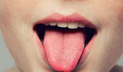 Pieczenie języka - przyczyny. Czy palenie języka może być objawem raka?