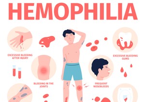 Ključne razlike između hemofilije A i B