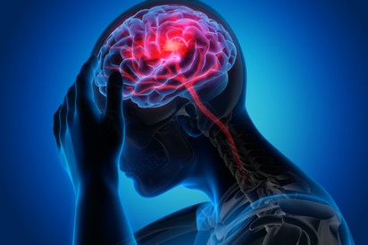 Stroke: a betegek harmada nem éli túl