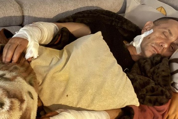 (FOTO) PSI LUTALICE IZUJEDALI BIVŠEG SPECIJALCA MUP Zadobio VIŠESTRUKE povrede, oglasila se i njegova ćerka: Horor na Ilidži