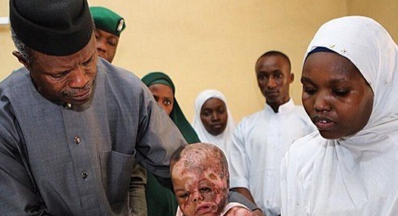 Vice President, Yemi Osinbajo with a child injured in a Boko Haram attack.